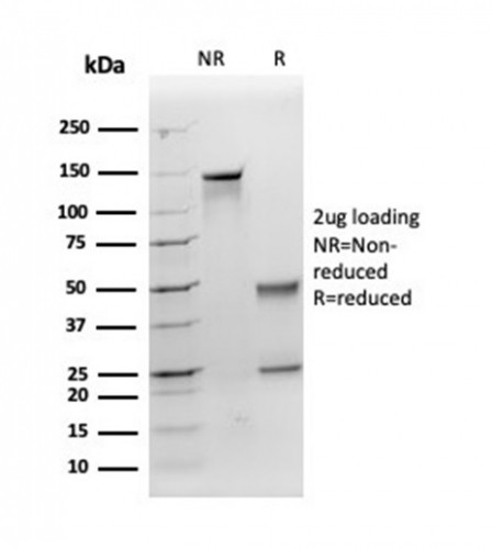 Apolipoprotein E/APOE Antibody in SDS-PAGE (SDS-PAGE)