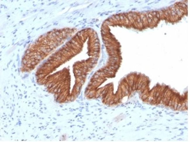 IGF1R/CD221 Antibody in Immunoelectrophoresis (IE)