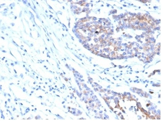 IGF1R/CD221 Antibody in Immunohistochemistry (Paraffin) (IHC (P))