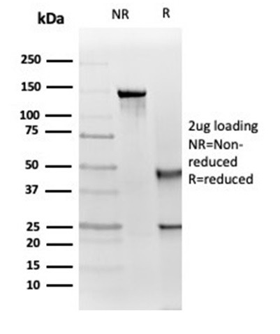 IGF1R/CD221 Antibody in Immunohistochemistry (Paraffin) (IHC (P))