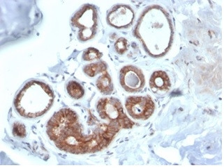 IGF1R/CD221 Antibody in Immunohistochemistry (Paraffin) (IHC (P))