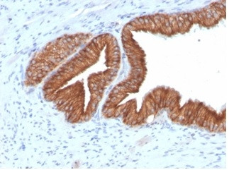 IGF1R/CD221 Antibody in SDS-PAGE (SDS-PAGE)