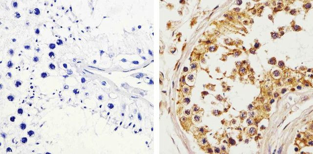 c-Kit Antibody in Immunohistochemistry (Paraffin) (IHC (P))