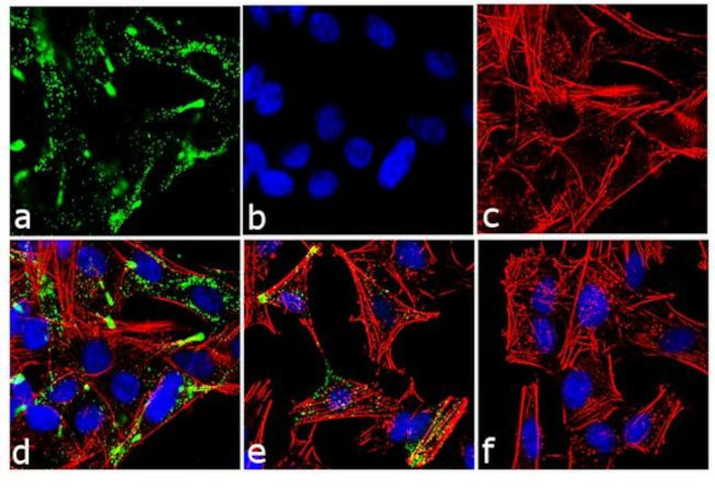 c-Kit Antibody in Immunocytochemistry (ICC/IF)