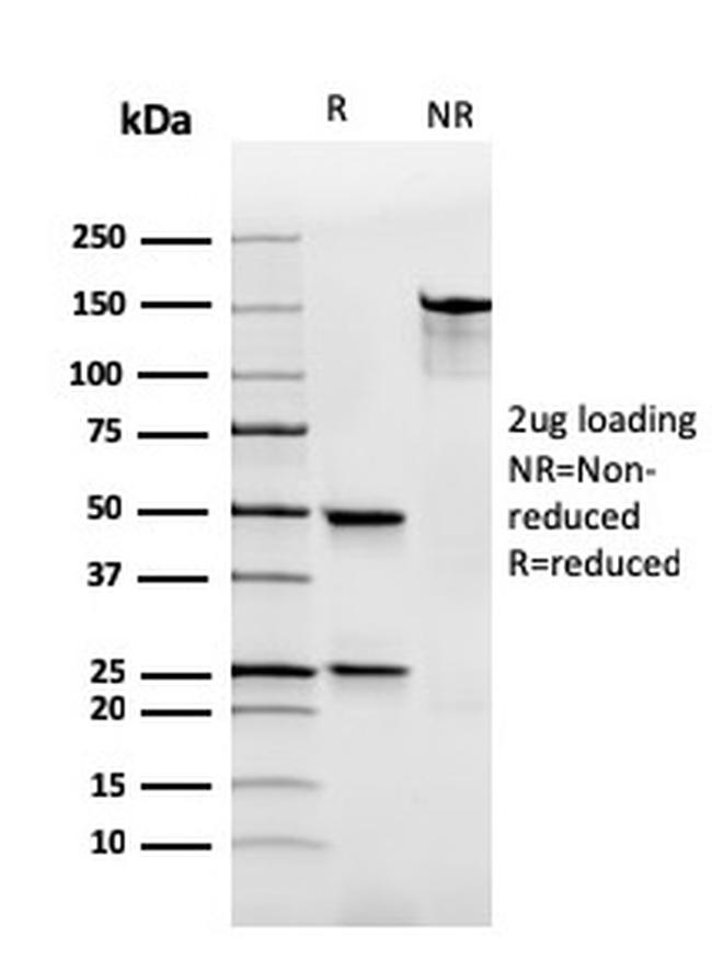 Immunoglobulin Alpha (IgA) Heavy Chain Antibody in SDS-PAGE (SDS-PAGE)