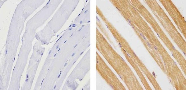 TBX1 Antibody in Immunohistochemistry (Paraffin) (IHC (P))