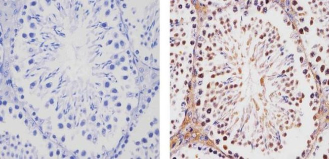 TBX1 Antibody in Immunohistochemistry (Paraffin) (IHC (P))