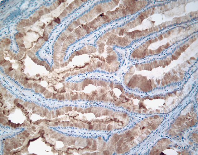 MUC4 Antibody in Immunohistochemistry (IHC)