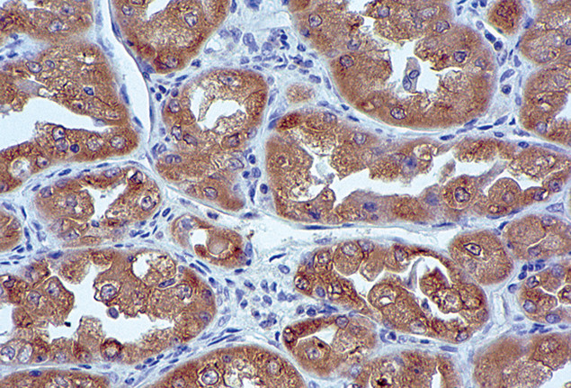 Ezrin Antibody in Immunohistochemistry (IHC)