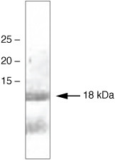 alpha Synuclein Antibody in Western Blot (WB)