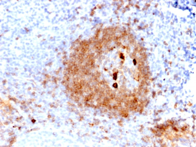 IgM (Immunoglobulin Mu Heavy Chain) Antibody in Immunohistochemistry (Paraffin) (IHC (P))