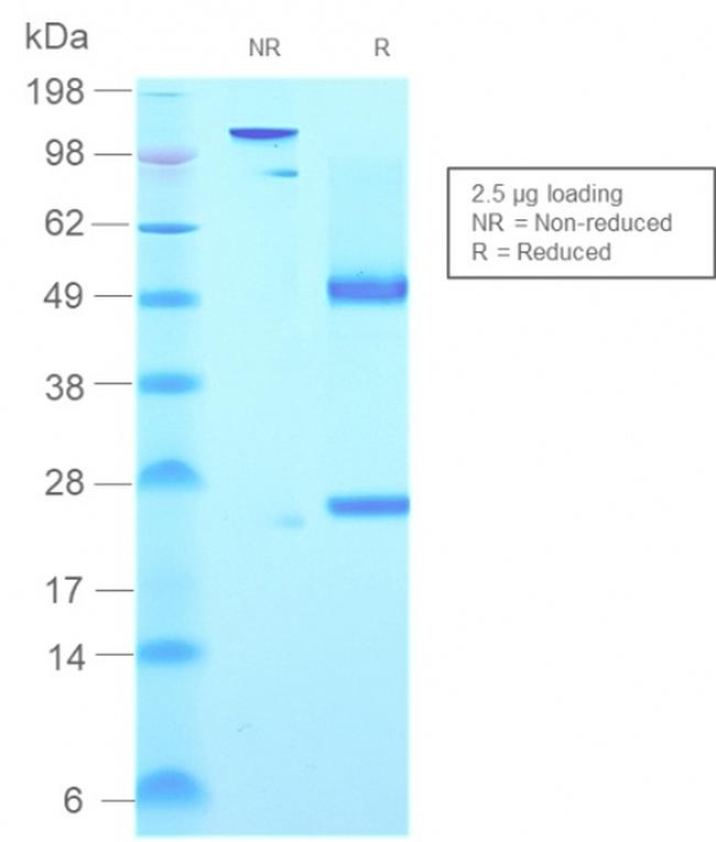 IgM (Immunoglobulin Mu Heavy Chain) Antibody in SDS-PAGE (SDS-PAGE)