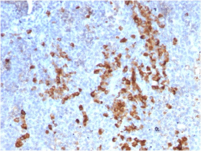 Kappa Light Chain/IGKC Antibody in Immunohistochemistry (Paraffin) (IHC (P))