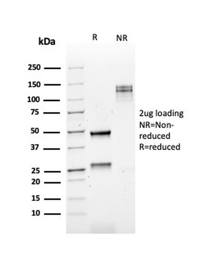 Kappa Light Chain/IGKC Antibody in SDS-PAGE (SDS-PAGE)