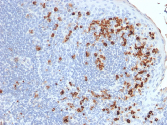 Kappa Light Chain Antibody in Immunohistochemistry (Paraffin) (IHC (P))