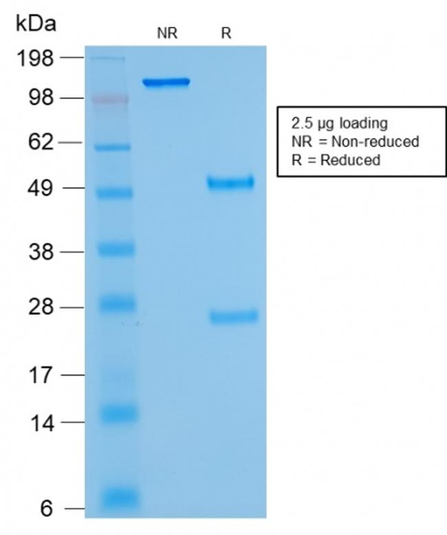 Kappa Light Chain Antibody in SDS-PAGE (SDS-PAGE)