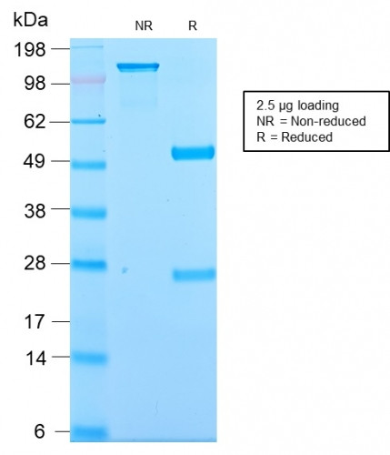 Kappa Light Chain/IGKC (B-Cell Marker) Antibody in SDS-PAGE (SDS-PAGE)