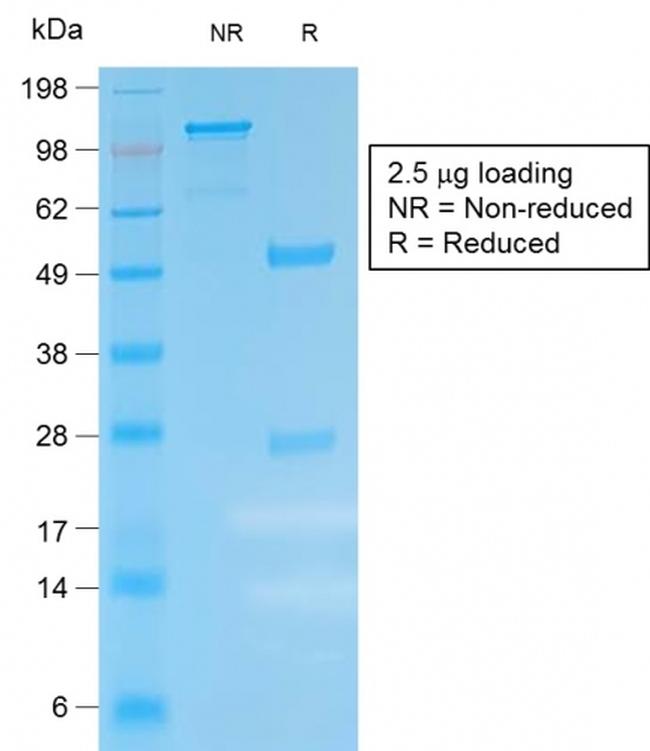 Kappa Light Chain Antibody in SDS-PAGE (SDS-PAGE)