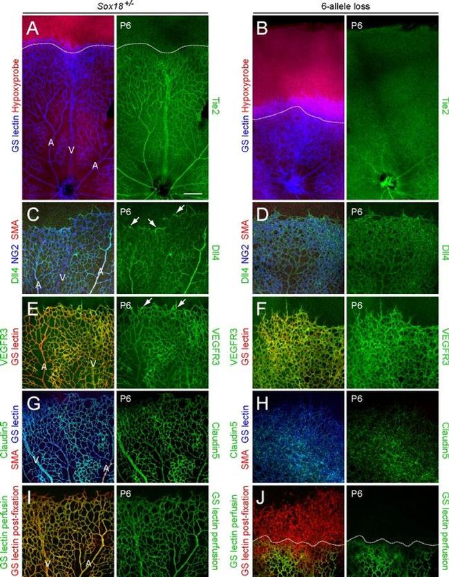 Claudin 5 Antibody in Immunohistochemistry (IHC)