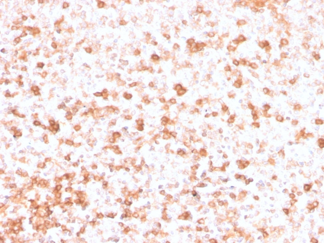 Lambda Light Chain Antibody in Immunohistochemistry (Paraffin) (IHC (P))