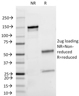 Lambda Light Chain (B-Cell Marker) Antibody in SDS-PAGE (SDS-PAGE)