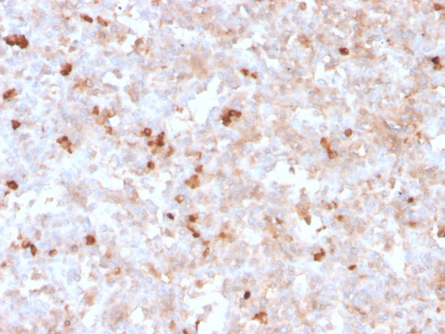 Lambda Light Chain Antibody in Immunohistochemistry (Paraffin) (IHC (P))