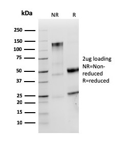 Lambda Light Chain (B-Cell Marker) Antibody in SDS-PAGE (SDS-PAGE)