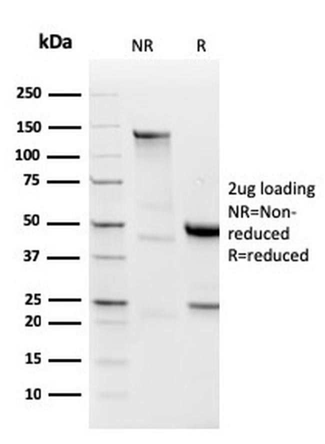 Lambda Light Chain Antibody in SDS-PAGE (SDS-PAGE)