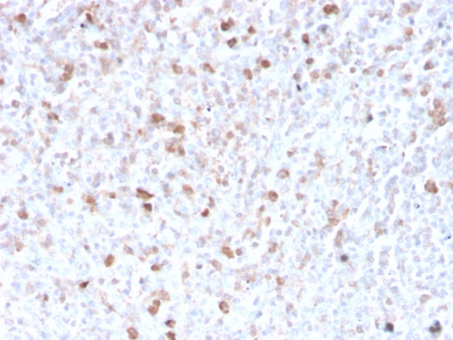 Lambda Light Chain Antibody in Immunohistochemistry (Paraffin) (IHC (P))