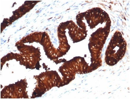 Prostate Specific Antigen (PSA) Antibody in Immunohistochemistry (Paraffin) (IHC (P))