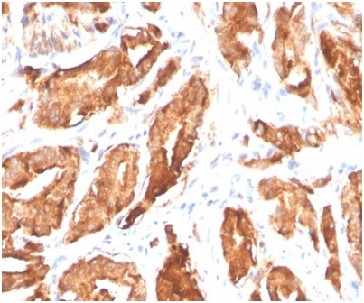 Prostate Specific Antigen (PSA) Antibody in Immunohistochemistry (Paraffin) (IHC (P))