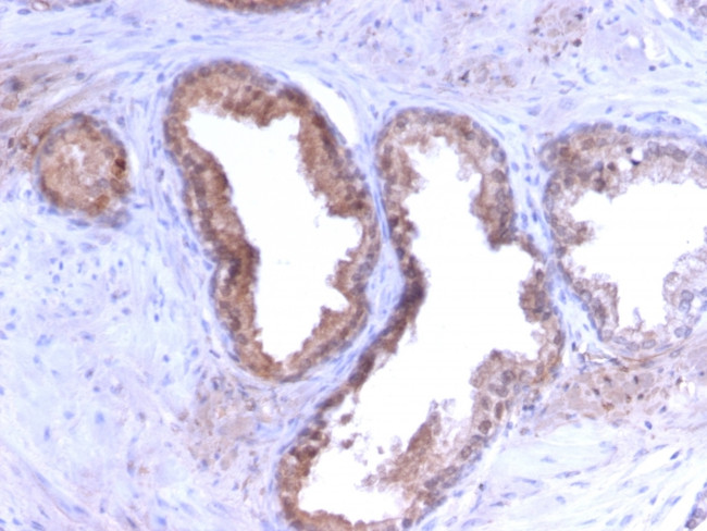 Prostate Specific Antigen (PSA) Antibody in Immunohistochemistry (Paraffin) (IHC (P))