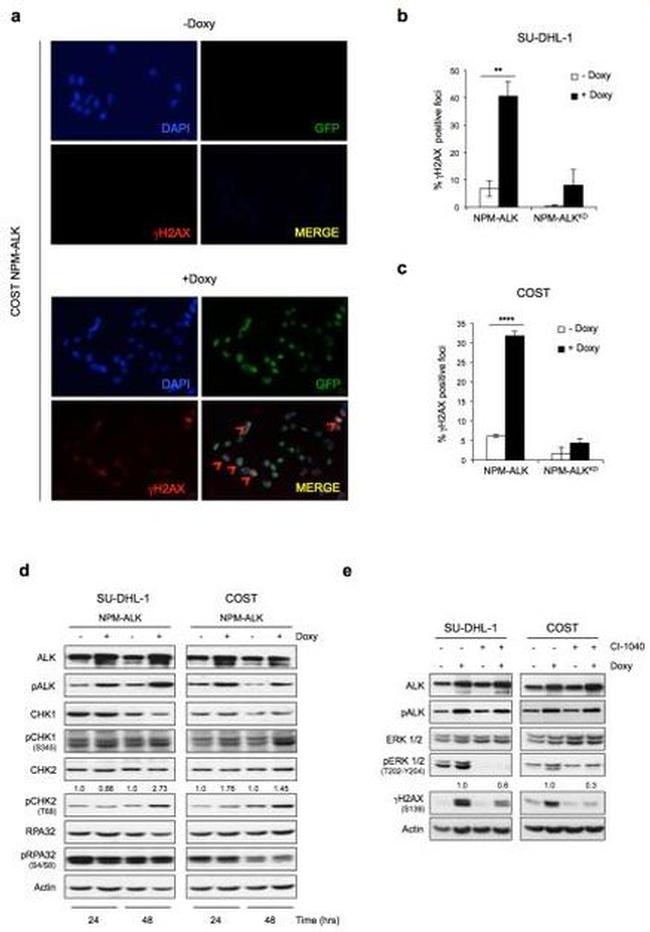 ALK Antibody in Western Blot (WB)