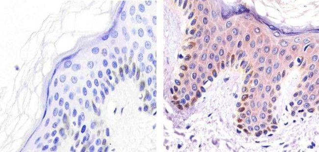 ALK Antibody in Immunohistochemistry (Paraffin) (IHC (P))