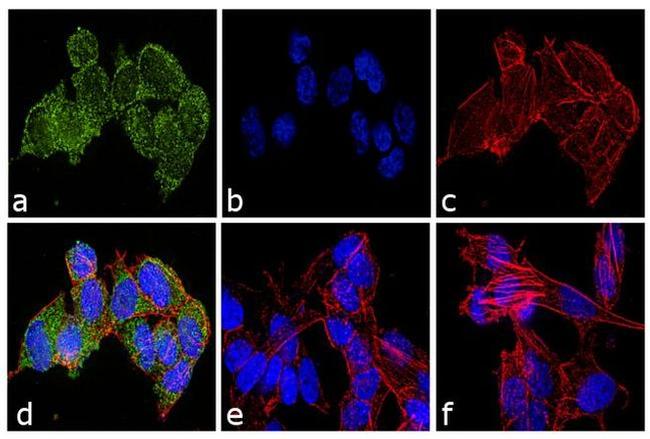 Ubiquilin 2 Antibody