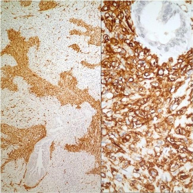 MUC4 Antibody in Immunohistochemistry (IHC)