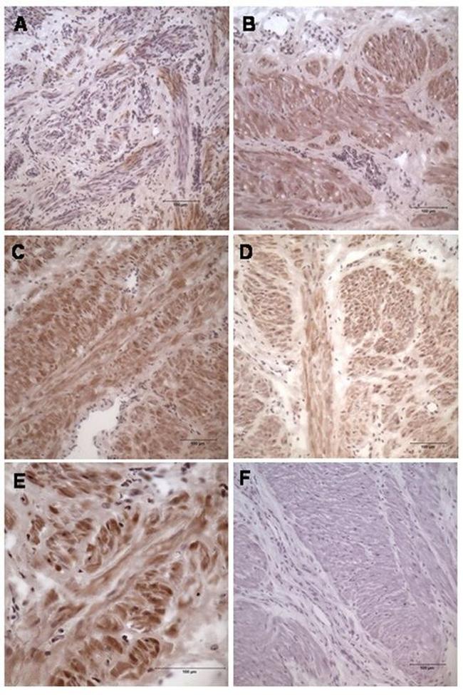 Connexin 43 Antibody in Immunohistochemistry (IHC)