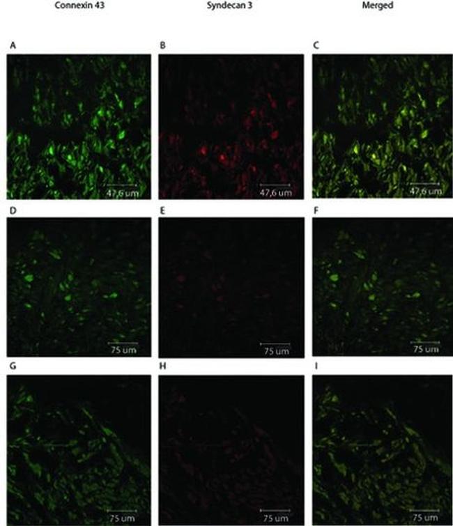 Connexin 43 Antibody in Immunohistochemistry (IHC)