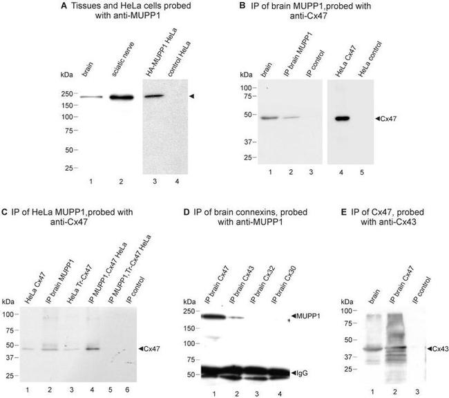 MUPP1 Antibody in Western Blot, Immunoprecipitation (WB, IP)