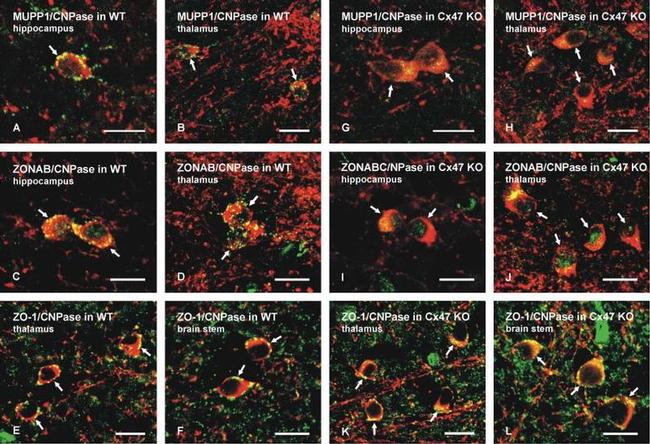 MUPP1 Antibody in Immunocytochemistry (ICC/IF)