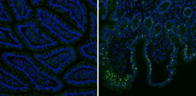 Mouse IgG (H+L) Secondary Antibody in Immunohistochemistry (Paraffin) (IHC (P))