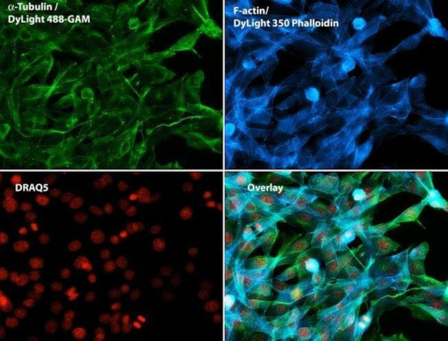 Mouse IgG (H+L) Secondary Antibody in Immunocytochemistry (ICC/IF)