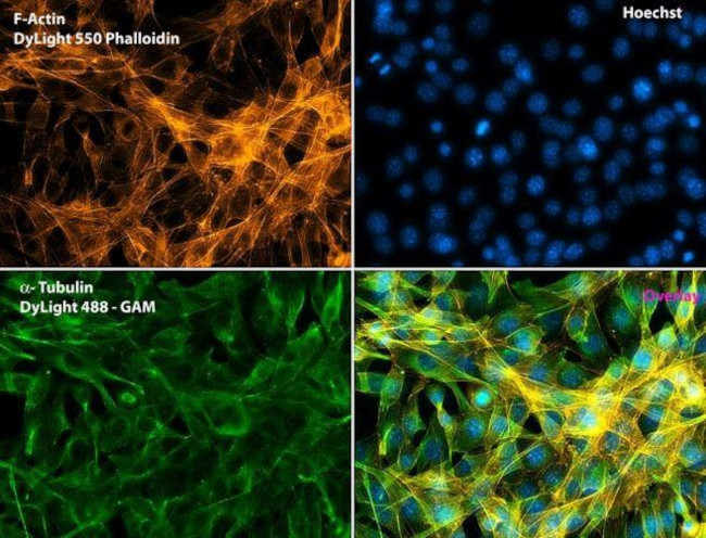 Mouse IgG (H+L) Secondary Antibody in Immunocytochemistry (ICC/IF)