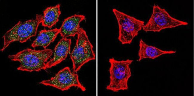 Mouse IgG (H+L) Cross-Adsorbed Secondary Antibody in Immunocytochemistry (ICC/IF)