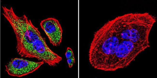 Mouse IgG (H+L) Cross-Adsorbed Secondary Antibody in Immunocytochemistry (ICC/IF)