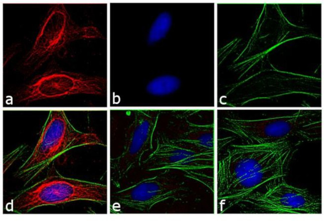 Mouse IgG (H+L) Secondary Antibody in Immunocytochemistry (ICC/IF)