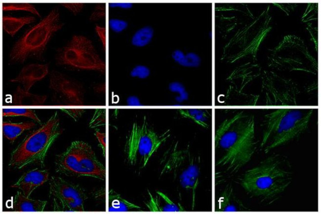 Mouse IgG (H+L) Secondary Antibody in Immunocytochemistry (ICC/IF)