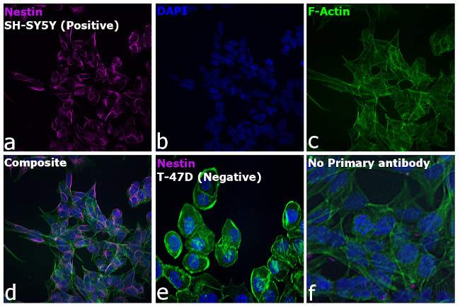 Mouse IgG (H+L) Cross-Adsorbed Secondary Antibody in Immunocytochemistry (ICC/IF)