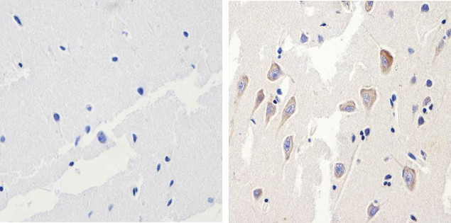 Phospho-Tau (Thr231) Antibody in Immunohistochemistry (Paraffin) (IHC (P))