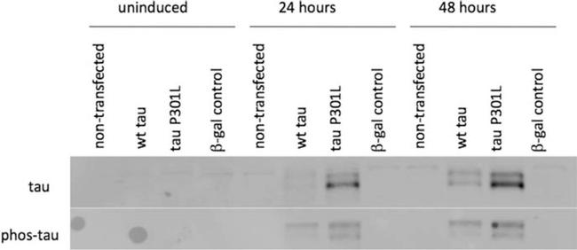 Phospho-Tau (Ser199, Ser202) Antibody in Western Blot (WB)